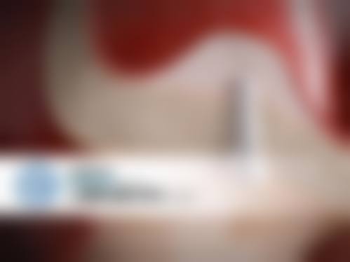 {红河半口种植在线咨询24小时：半口半固定1.5万-2.3万，红河皓雅口腔数字化导板种植好评多！ 