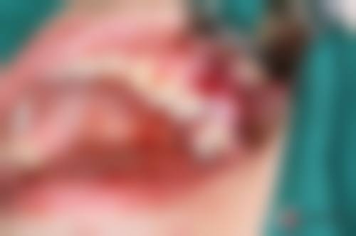 红河半口种植技术多样