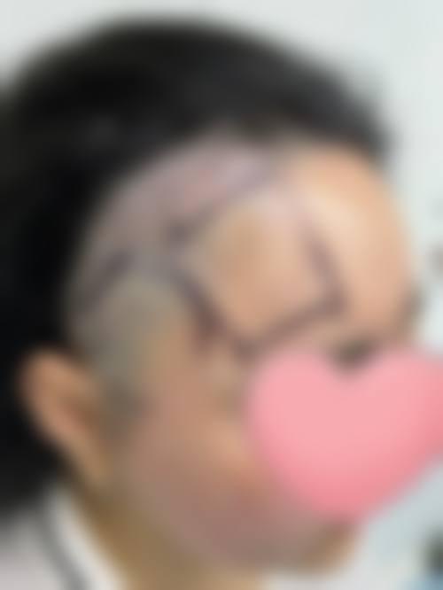 二、昆明馨雨医疗美容诊所是正规医院吗