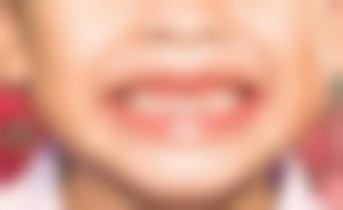 周丽医生：龋病预防与治疗骨干医生