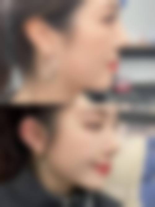 五、呼和浩特一韩医疗美容门诊部收费价格表