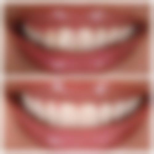 {赣州牙科在线咨询24小时，赣州金赣口腔技术靠谱、价格透明，种植牙1888起！ 