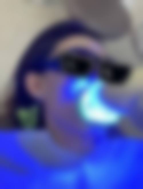 {内蒙古牙齿美白在线咨询24小时！多家口腔机构及专家，为你解锁亮白秘诀 