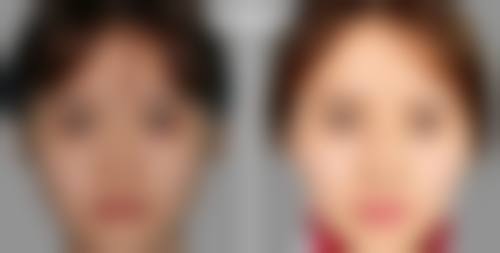 五、西安爱洛慕梵整形医院口碑怎么样？