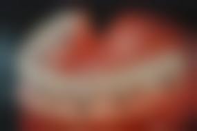 {浦江县半口种植医院在线咨询24小时：All-on-4技术半口3.8万起，还有中老年友好服务等！ 