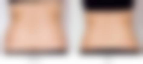 四、西安爱洛慕梵整形医院收费价格表