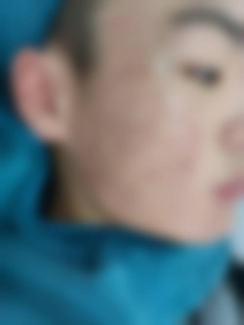 五、阳泉城南皮肤病医院收费价格表