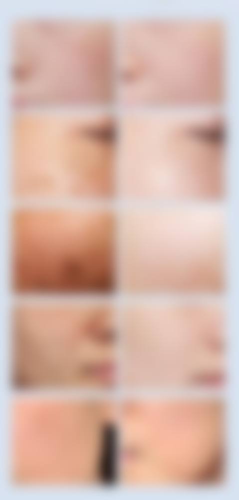 二、阳泉城南皮肤病医院是正规医院吗？