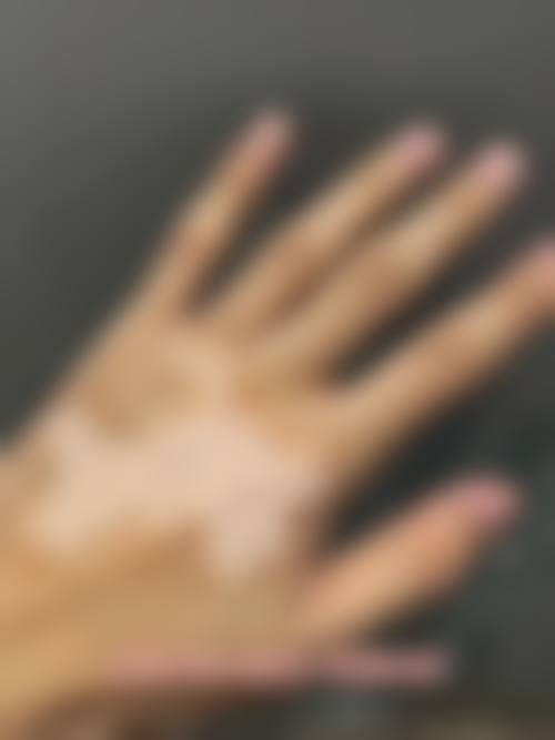 六、阳泉城南皮肤病医院口碑怎么样？