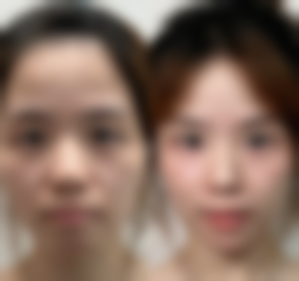 二、武汉贝蓓国内外医疗整形美容医院是正规医院吗