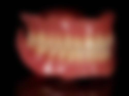 不戴牙冠牙齿可能出现的问题及后果