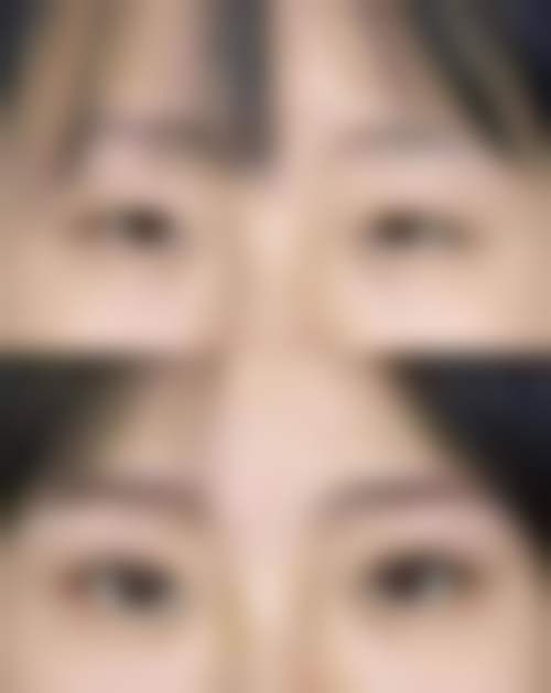 四、水之森美容外科名古屋院特色项目及技术优势