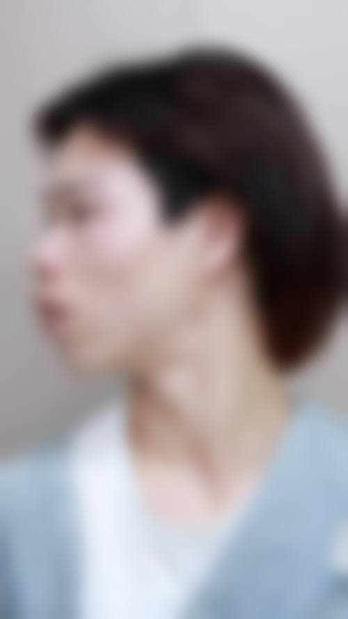 {安阳隐形矫正医生在线咨询24小时，多医院多医生可选，助你畅享隐形矫正变美之旅！ 