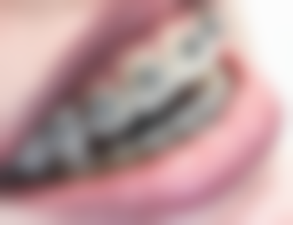 术后护理对疼痛消失时间的影响