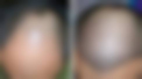 六、威海正源整形美容收费价格表