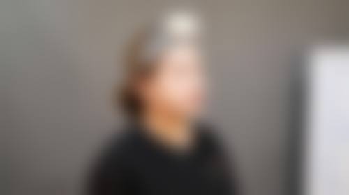 五、衡阳婉媄伊思雅医疗美容门诊部收费价格表