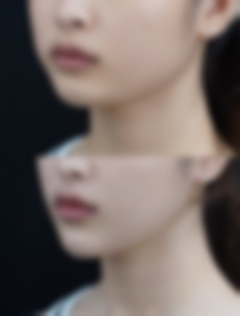 六、衡阳婉媄伊思雅医疗美容门诊部口碑怎么样？