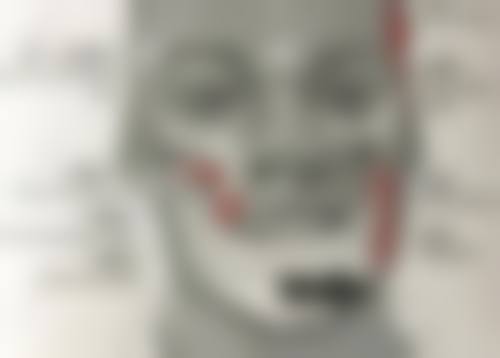 东阳全口种植医院24小时在线咨询：金华东阳狐狸口腔技术出色，诺贝尔种植体1.2w - 1.8w！ 