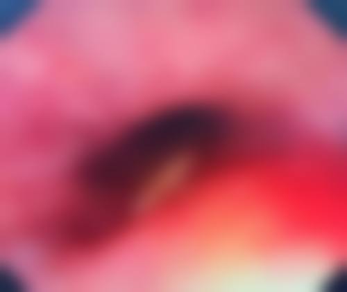 六、清潭jayderma医院收费价格表