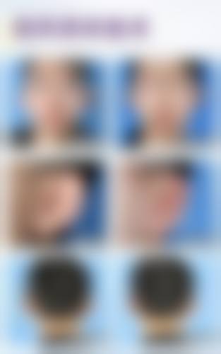 四、上海新极点美容整形诊所特色项目及技术优势