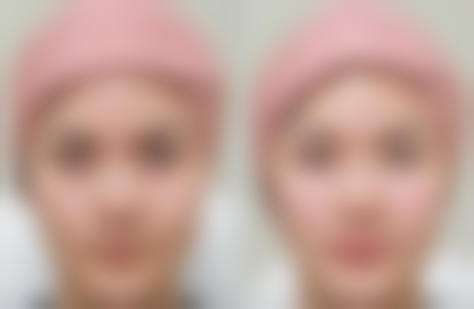 三、华瑞医疗美容门诊部特色项目及技术优势