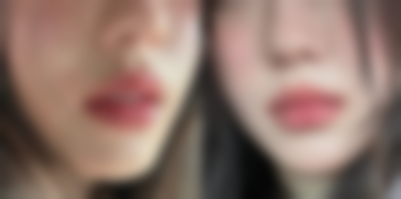 四、清潭jayderma医院特色项目及技术优势