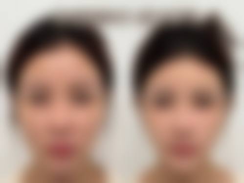 五、成都莱尹臻颜医疗美容门诊部收费价格表