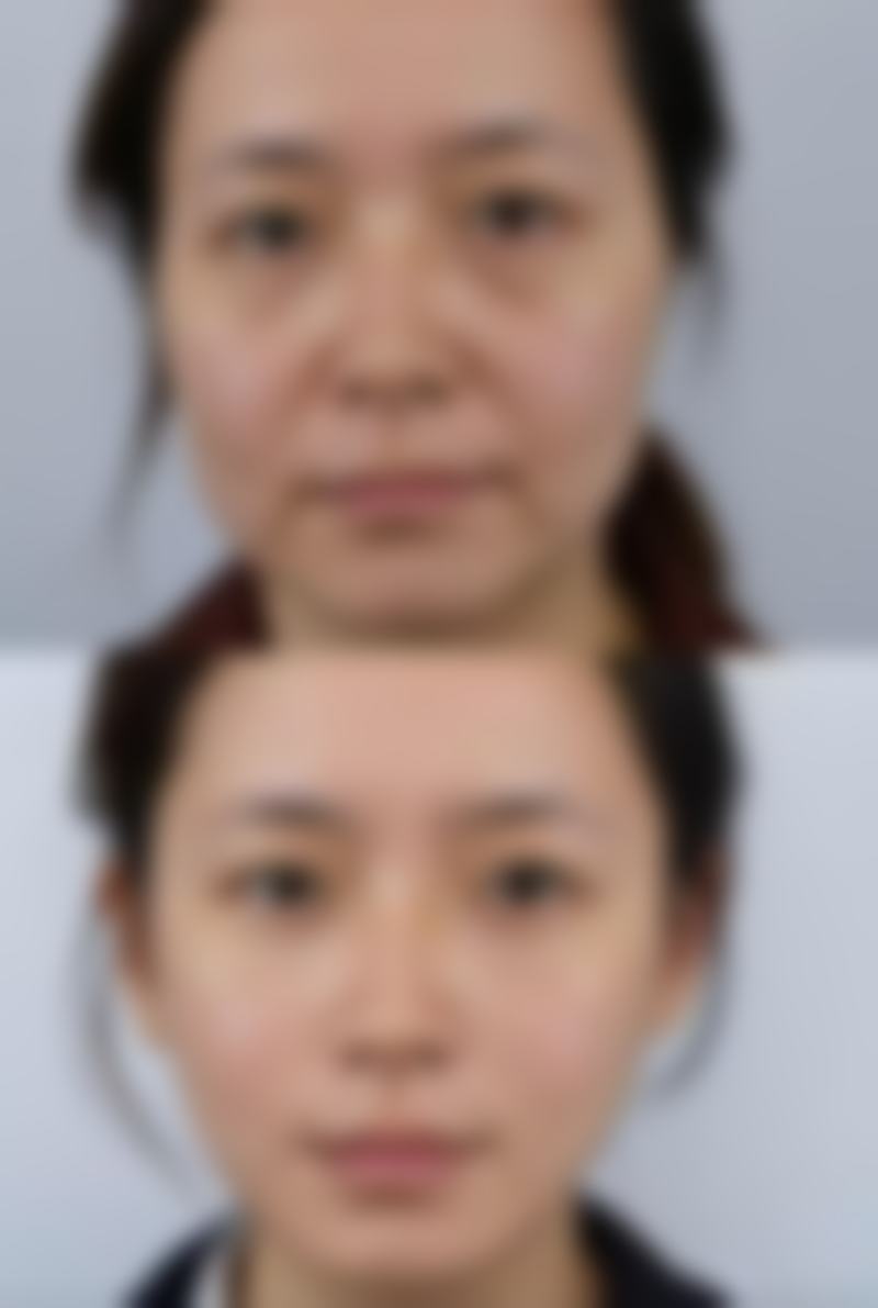 五、贵阳一艺美医疗美容诊所收费价格表