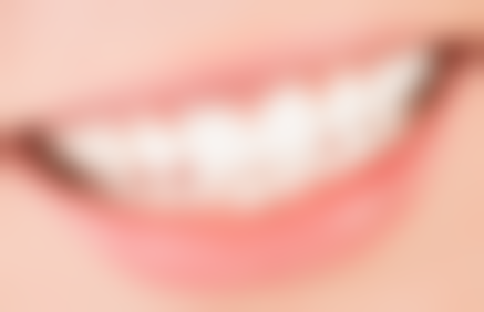 不同医院超声波洗牙信息大比拼