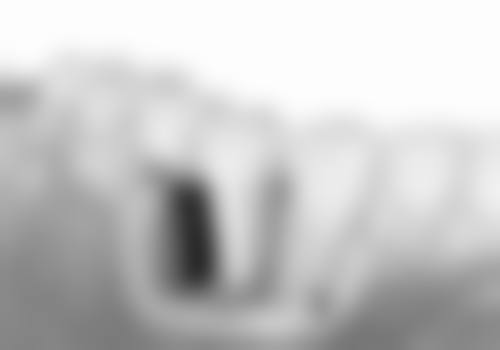 新疆医 科 大学附属医院镶牙价格