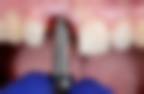 田晨医生:经验多的镶牙骨干医生