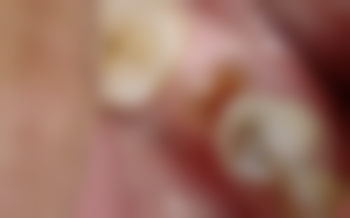 张昀医生:专精的口腔诊疗服务