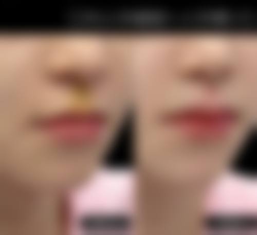 五、东莞东华医院烧伤整形美容科医生简介