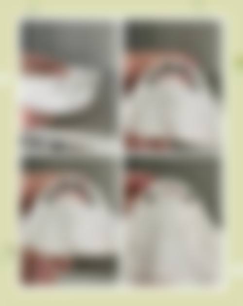 周宏医生：定制微笑线的高手