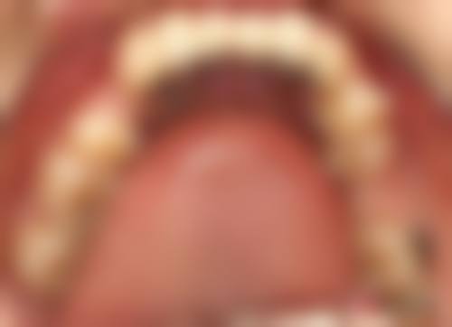 圣贝口腔:性价比高的正畸选择