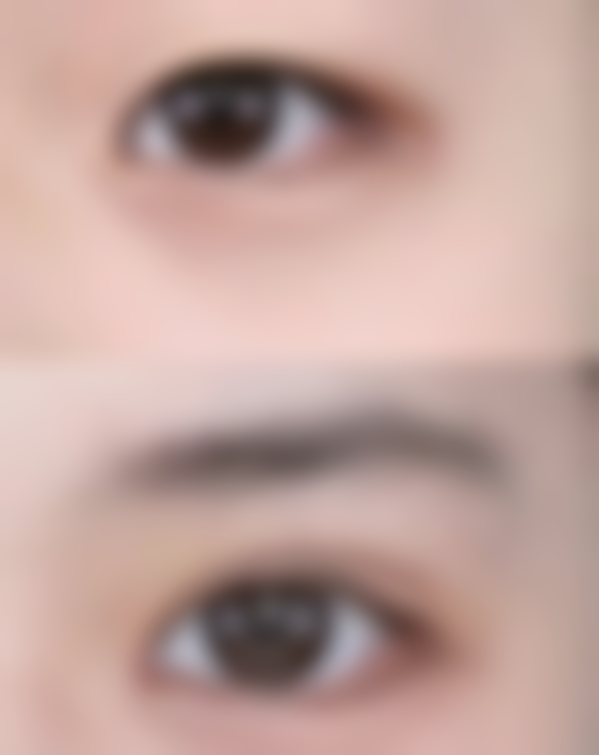 四、东莞东华医院烧伤整形美容科特色项目及技术优势