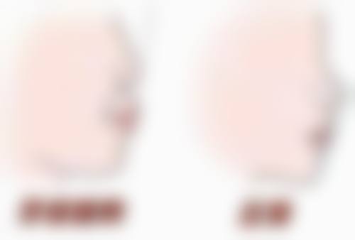 牙齿自身状况:影响治疗成效的内在因素