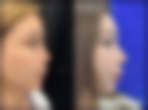 六、韩国dr.朵整形医院收费价格表