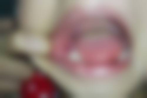 {武义县儿童齿科医生在线咨询24小时，权威解答乳牙滞留、龋齿等儿童口腔疑难病！ 