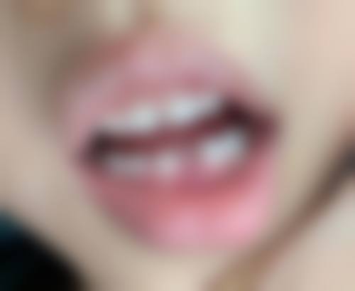 武义县口腔医院儿童齿科医生