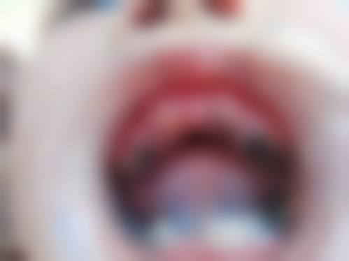 妇幼保健院儿科口腔医生