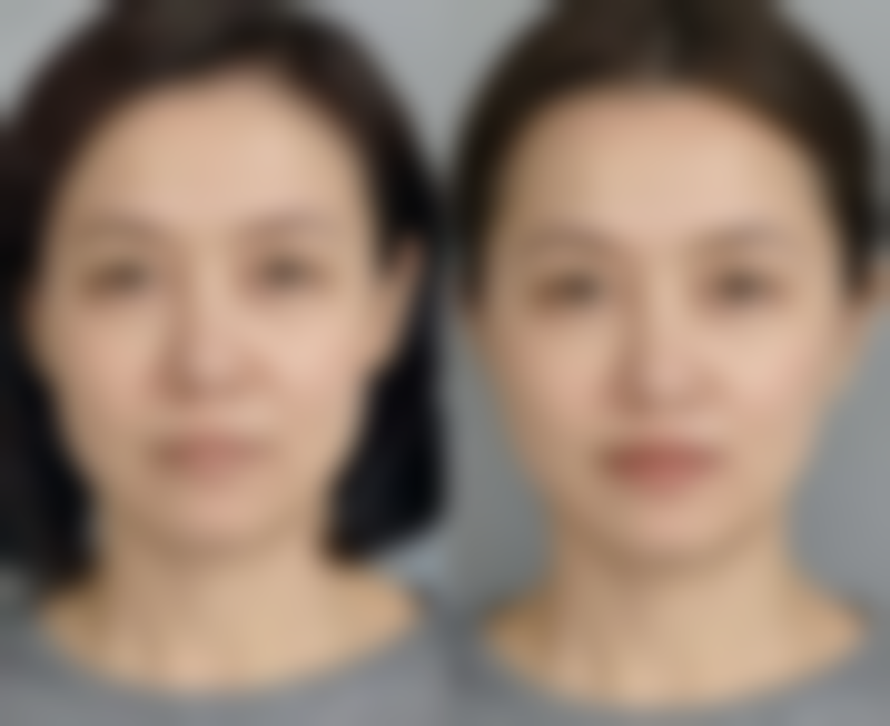 四、韩国dr.朵整形医院特色项目及技术优势