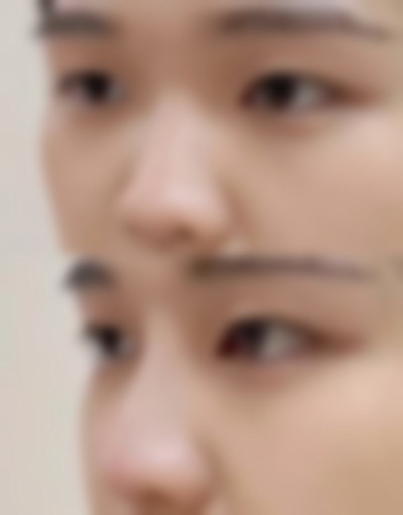 二、广州焕新医疗美容诊所是正规医院吗?