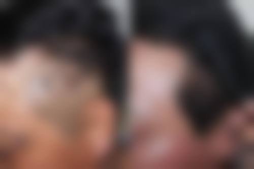 二、银川首欣植发是正规医院吗?