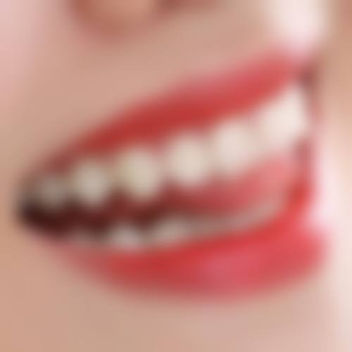 洗牙害处二：牙龈出血，正常现象莫惊慌