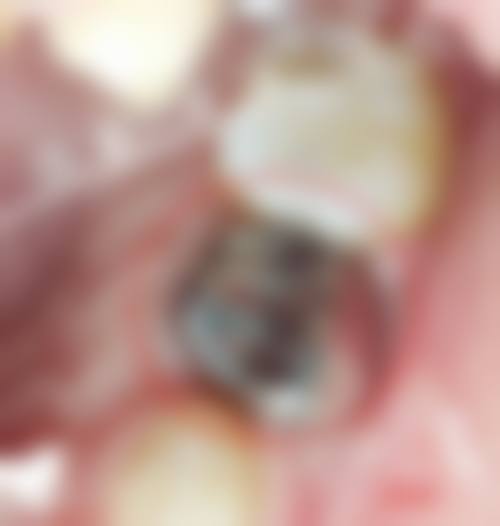 渭南友道口腔优势