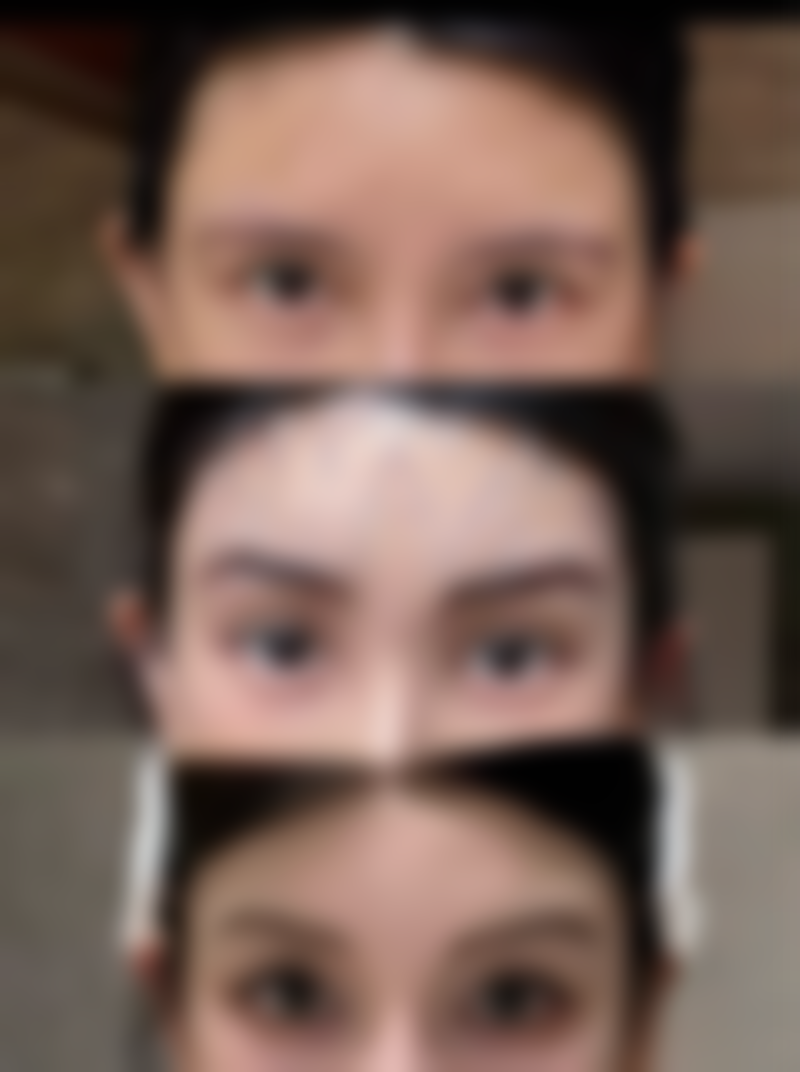 五、银川首欣植发收费价格表