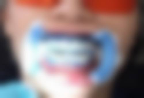 口腔卫生状况，影响牙冠使用时长