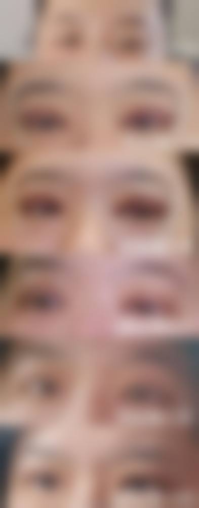 三、西安悦时光医疗美容诊所特色项目及技术优势