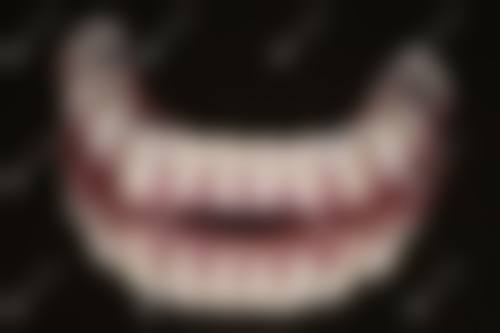 保山德韩口腔种植优势